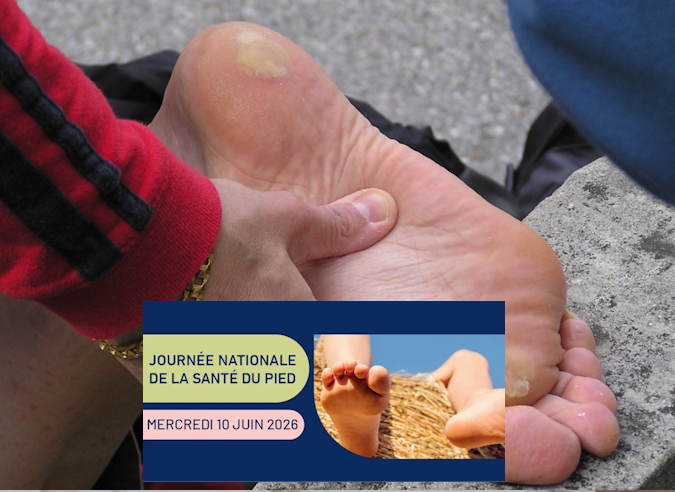 La Journée nationale de la santé du pied, 10 juin 
